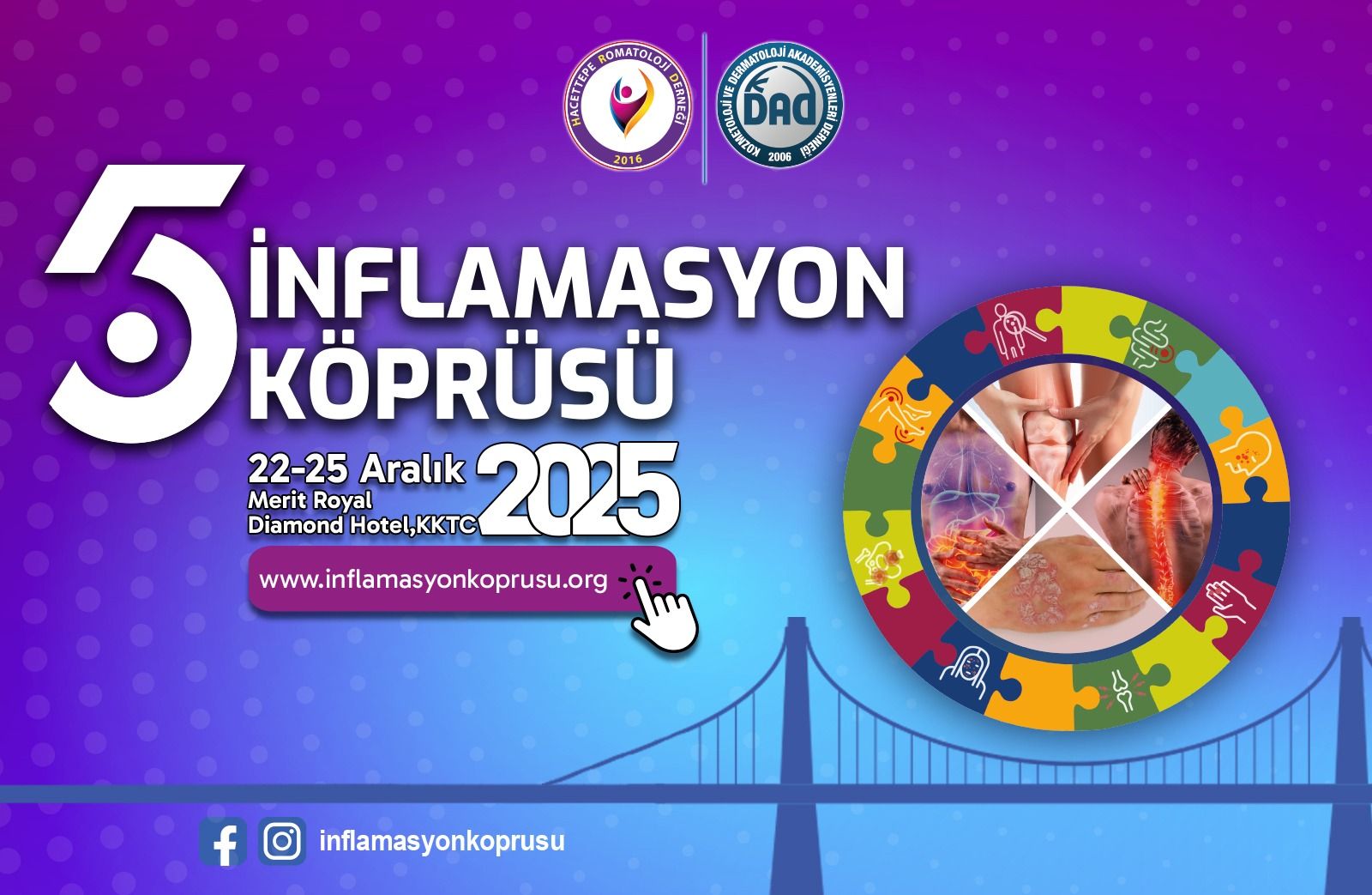 5. İnflamasyon Köprüsü