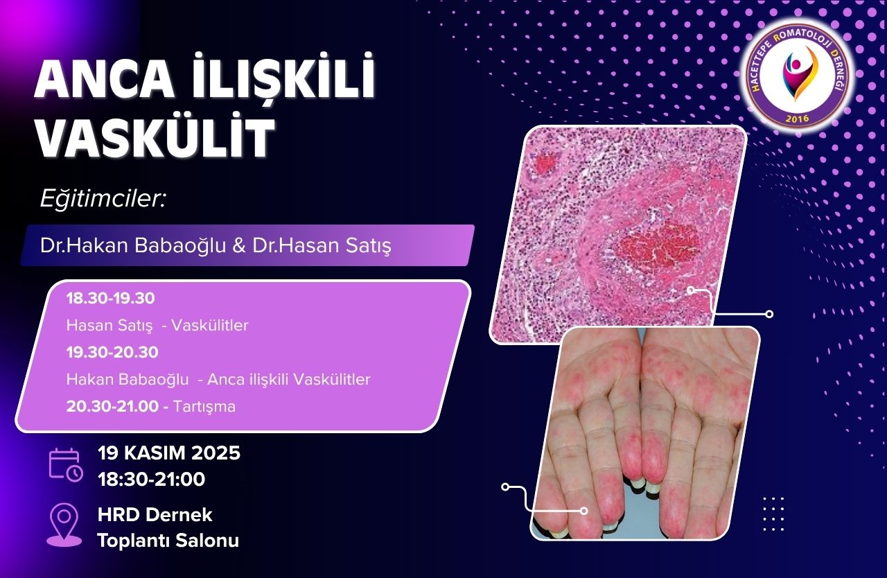 Anca İlişkili Vaskülit